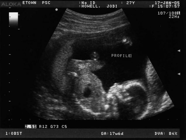 ultrasound_elizabeth_01.jpg