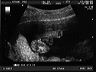 Ultrasound_Elizabeth_02.tif